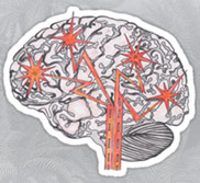 Brain in Pain visualisation