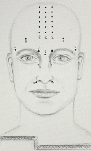 Headache pressure points